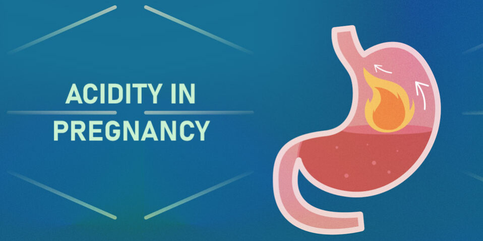 Acidity in pregnancy
